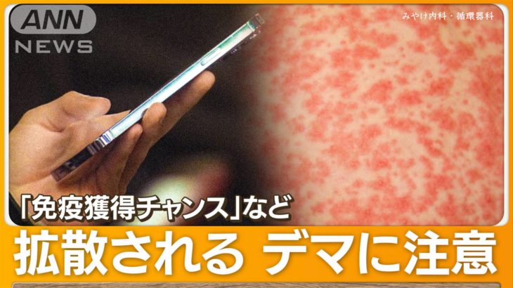 【SNS】はしか“自らかかりに”SNSで誤情報蔓延　昔の迷信「絶対ダメ」　医師が警鐘