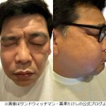 【芸能】上白石萌歌、“サンド富澤の顔パンパン”副鼻腔炎に「実は私もなったことがありまして」