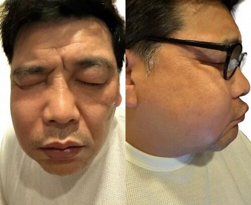 【芸能】上白石萌歌、“サンド富澤の顔パンパン”副鼻腔炎に「実は私もなったことがありまして」