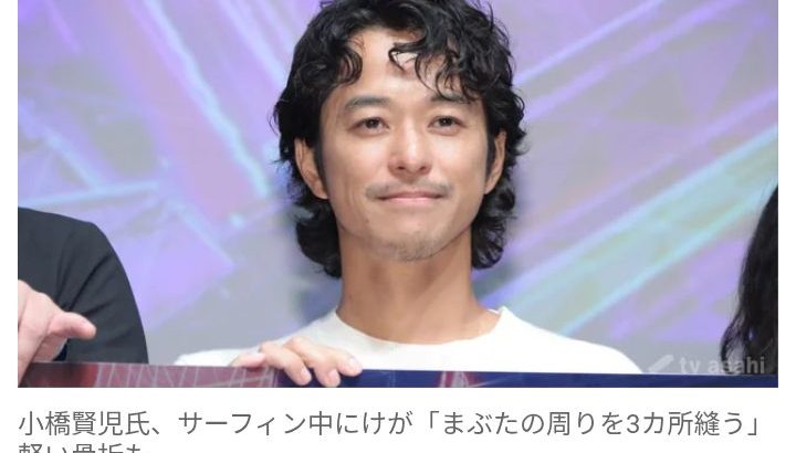 【芸能】元俳優・小橋賢児氏、サーフィン中にけが「まぶたの周りを3カ所縫う」　軽い骨折も