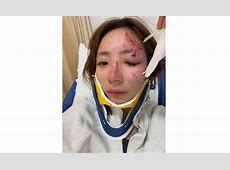 釣りアイドル・神野梓の事故とは？衝撃の現場を公開！